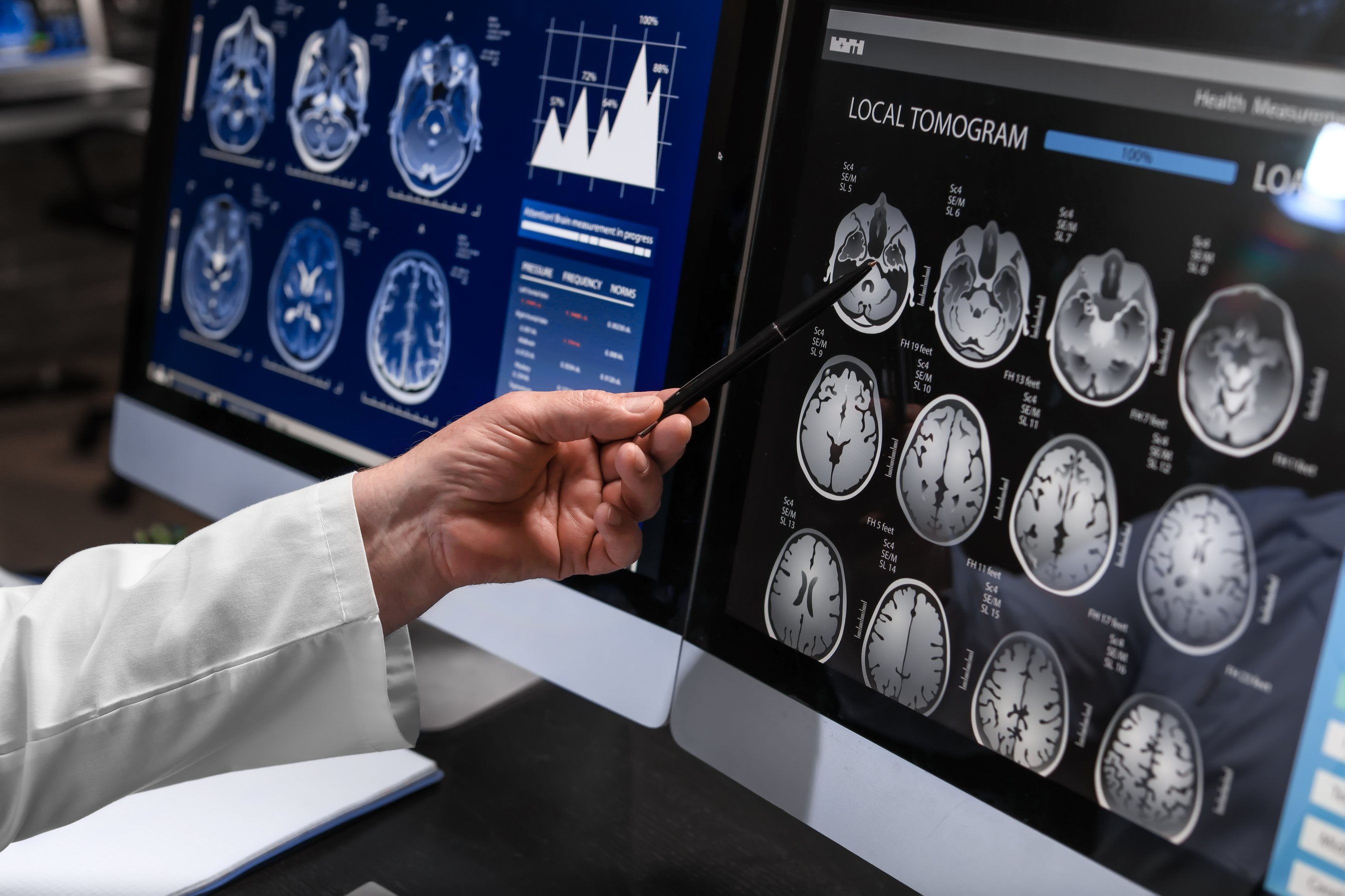 Neurologist with MRI Scan of Human Head in Clinic